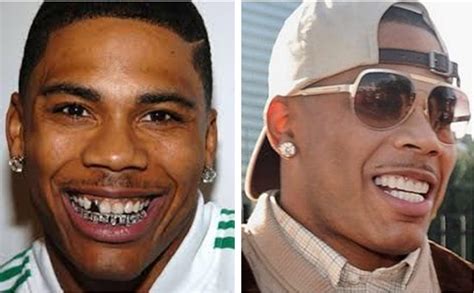 are nelly's teeth fake